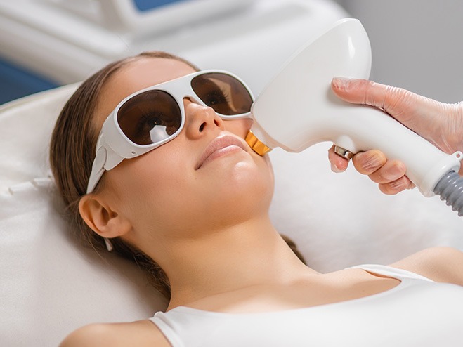 laser hair removal (face area)