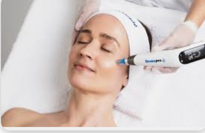 Dermapen facial