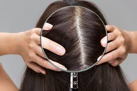 Scalp Treatment